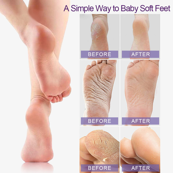 evpct Exfoliating Foot Peel Mask 3 Pack,Exfoliator Peel Off Calluses Dead Skin Callus Remover,Baby Soft Smooth Touch Feet-Men Women (Lavender-3Pack)
