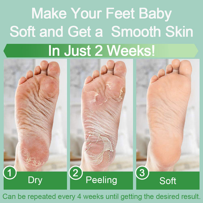 evpct Exfoliating Foot Peel Mask 2 Pack,Exfoliator Peel Off Calluses Dead Skin Callus Remover,Baby Soft Smooth Touch Feet-Men Women (Aloe-2Pack)