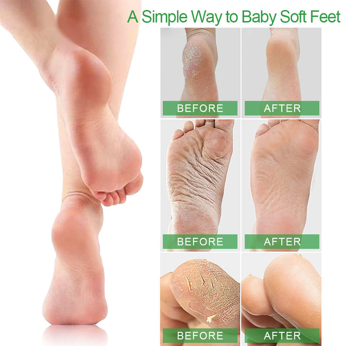 evpct Exfoliating Foot Peel Mask 3 Pack,Exfoliator Peel Off Calluses Dead Skin Callus Remover,Baby Soft Smooth Touch Feet-Men Women (Aloe-3Pack)