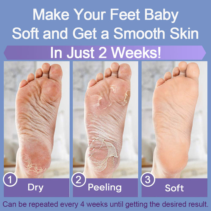 evpct Exfoliating Foot Peel Mask 3 Pack,Exfoliator Peel Off Calluses Dead Skin Callus Remover,Baby Soft Smooth Touch Feet-Men Women (Lavender-3Pack)
